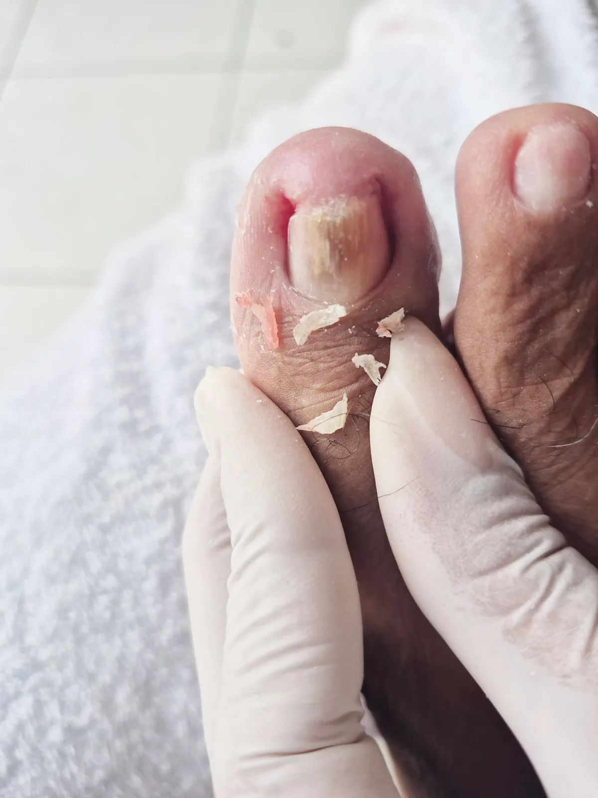 Tratamento de podologia na Refinada Beauty, em Maceió