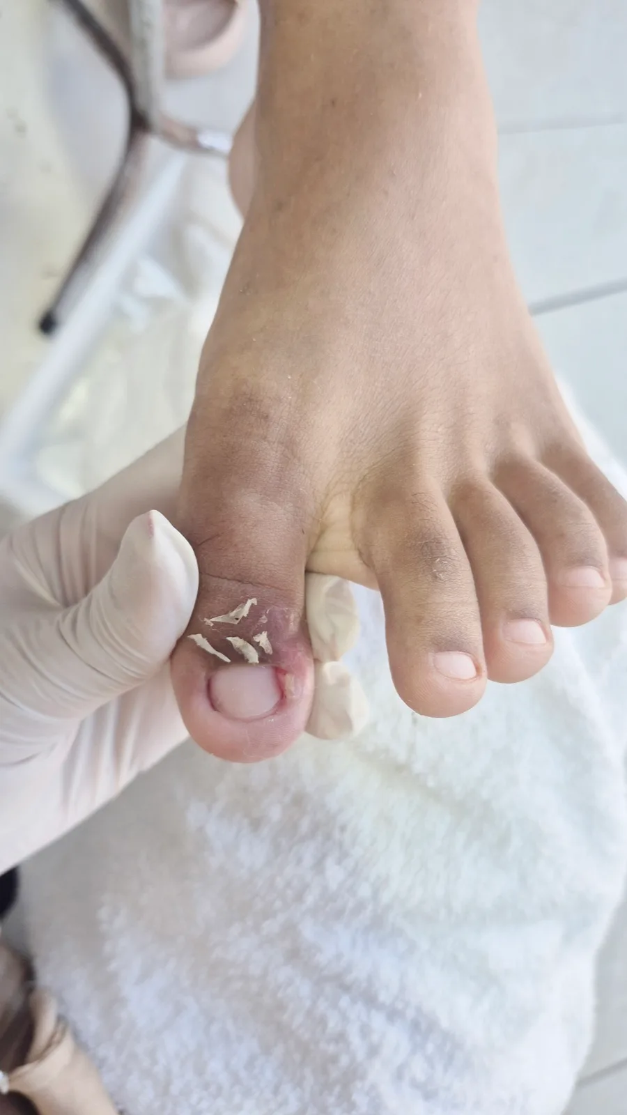 Tratamento de podologia na Refinada Beauty, em Maceió